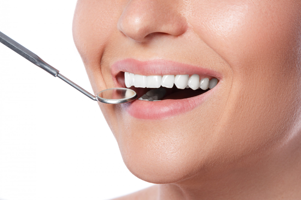 Tooth whitening
